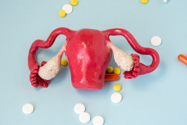 女性不孕,輸卵管堵塞,輸卵管不孕做試管