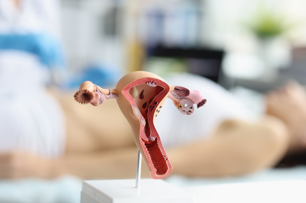 試管嬰兒,試管促排,試管副作用